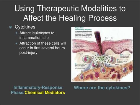 Using Therapeutic Modalities 